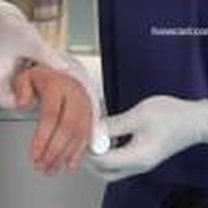 bandażowanie ręki