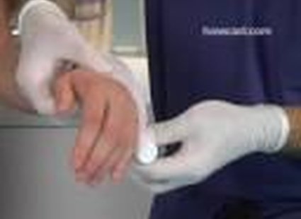 bandażowanie ręki