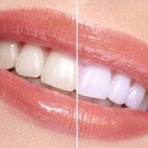wybielanie zębów skórką pomarańczową - krok 4