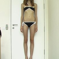 anoreksja
