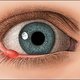 jak leczyć jęczmień na oku?