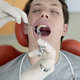Wyrywanie zęba