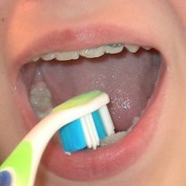 Wewnętrzna powierzchnia dolnych zębów