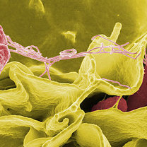 bakteria salmonelli