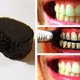 wybielanie zębów węglem