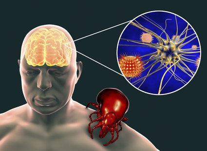 Zdjęcia z porady: Najczęstsze powikłania boreliozy - tipy.pl